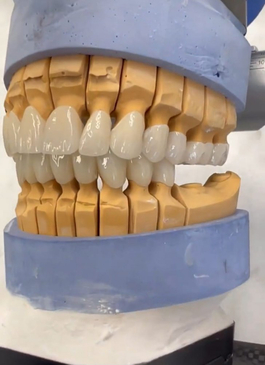 Slider image (8) Neo Dental Clinic